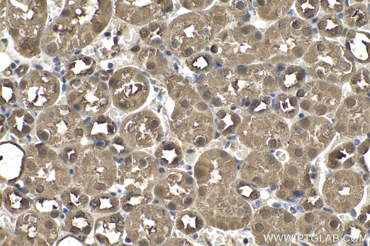 Immunohistochemistry (IHC) staining of mouse kidney tissue using MDH1 Polyclonal antibody (15904-1-AP)