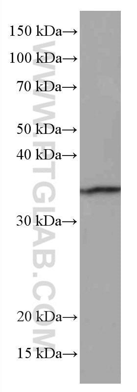 WB analysis of RAW 264.7 using 66505-1-Ig