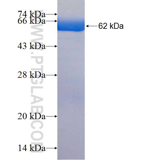 MDH1 fusion protein Ag8744 SDS-PAGE