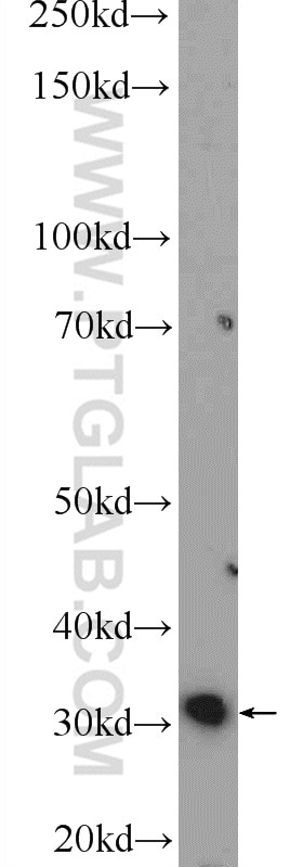 WB analysis of mouse lung using 15462-1-AP