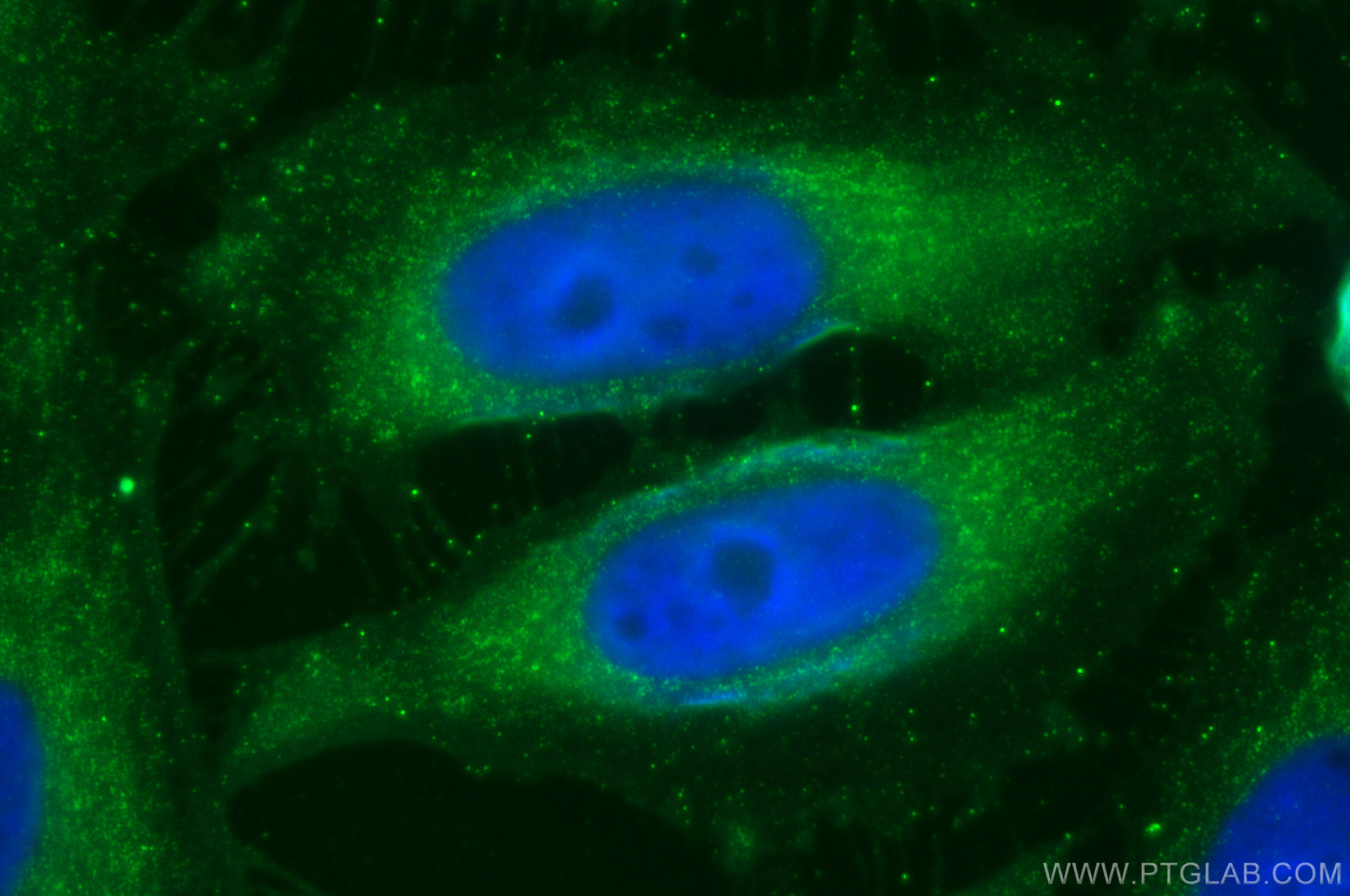 Immunofluorescence (IF) / fluorescent staining of HeLa cells using Midkine Polyclonal antibody (11009-1-AP)