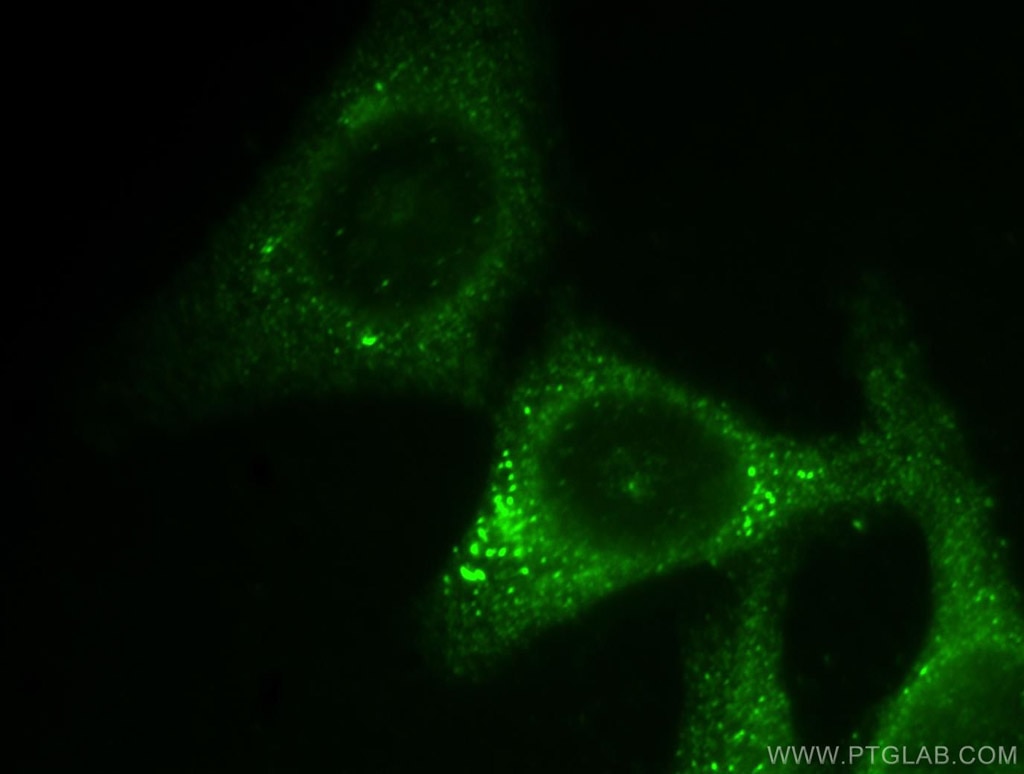 Midkine Polyclonal antibody