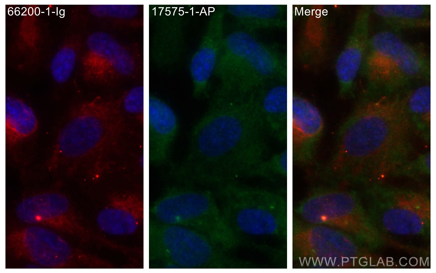 Immunofluorescence (IF) / fluorescent staining of hTERT-RPE1 cells using MDM1 Polyclonal antibody (17575-1-AP)