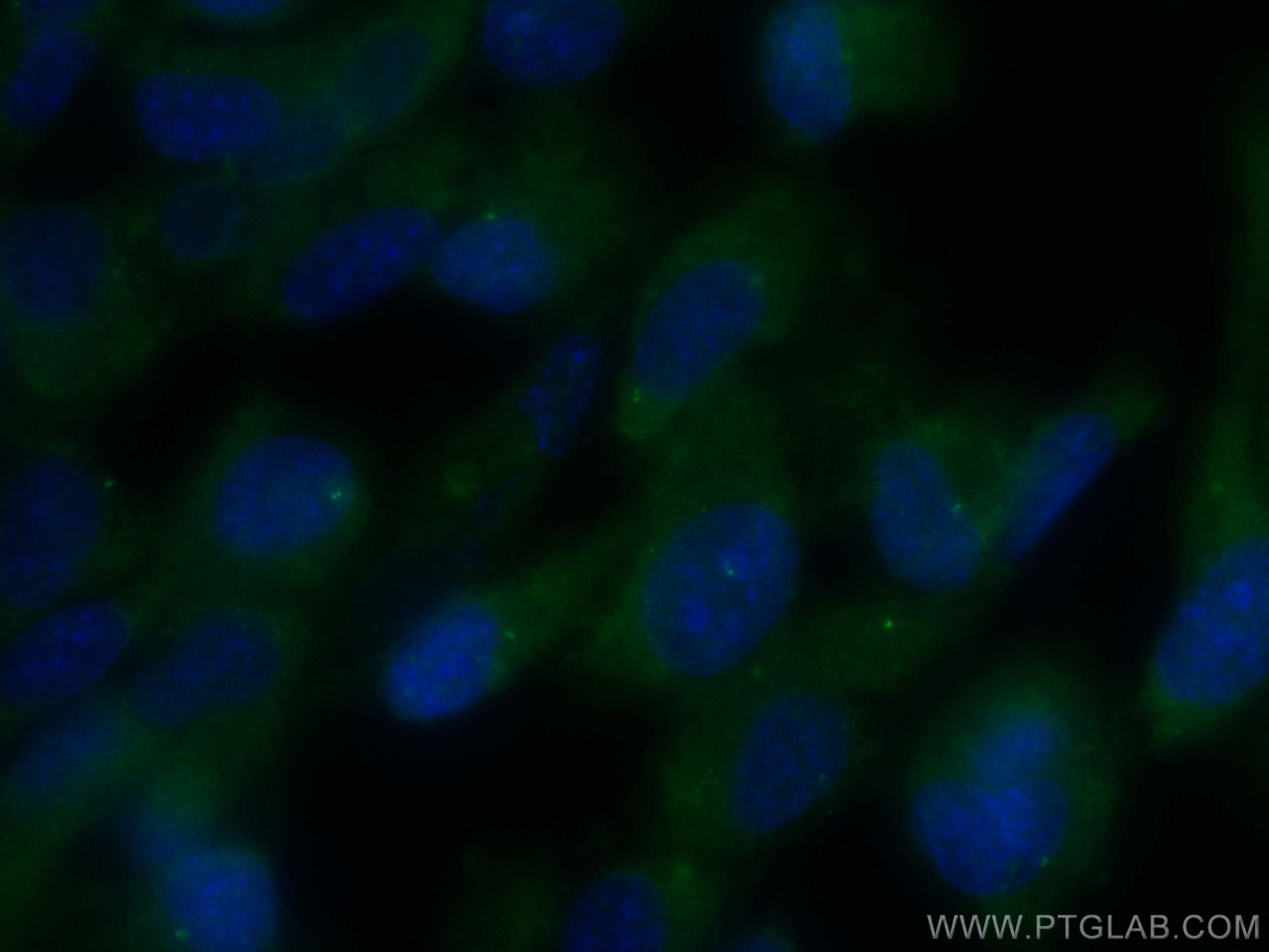 Immunofluorescence (IF) / fluorescent staining of hTERT-RPE1 cells using MDM1 Polyclonal antibody (17575-1-AP)