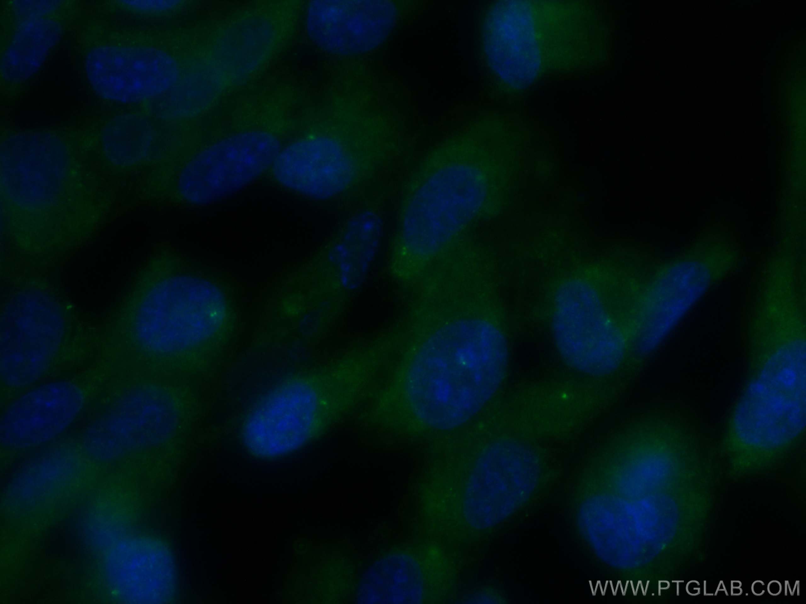 IF Staining of hTERT-RPE1 using 17575-1-AP