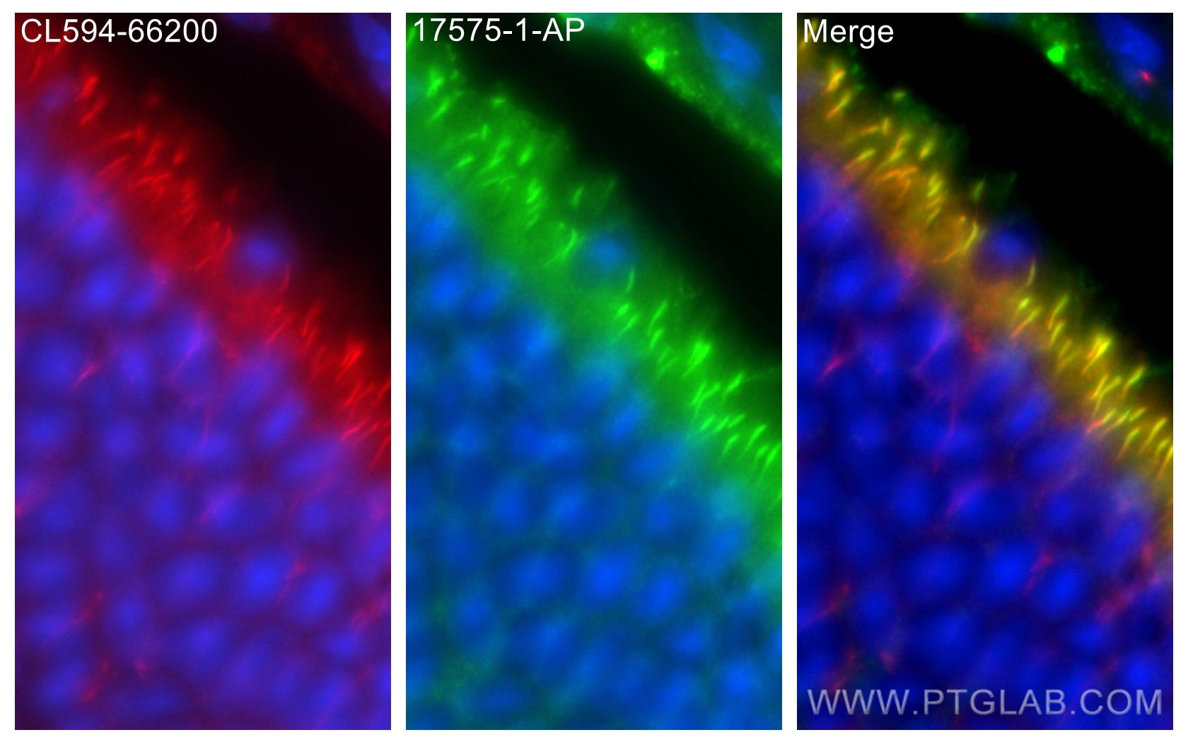 Immunofluorescence (IF) / fluorescent staining of mouse eye tissue using MDM1 Polyclonal antibody (17575-1-AP)