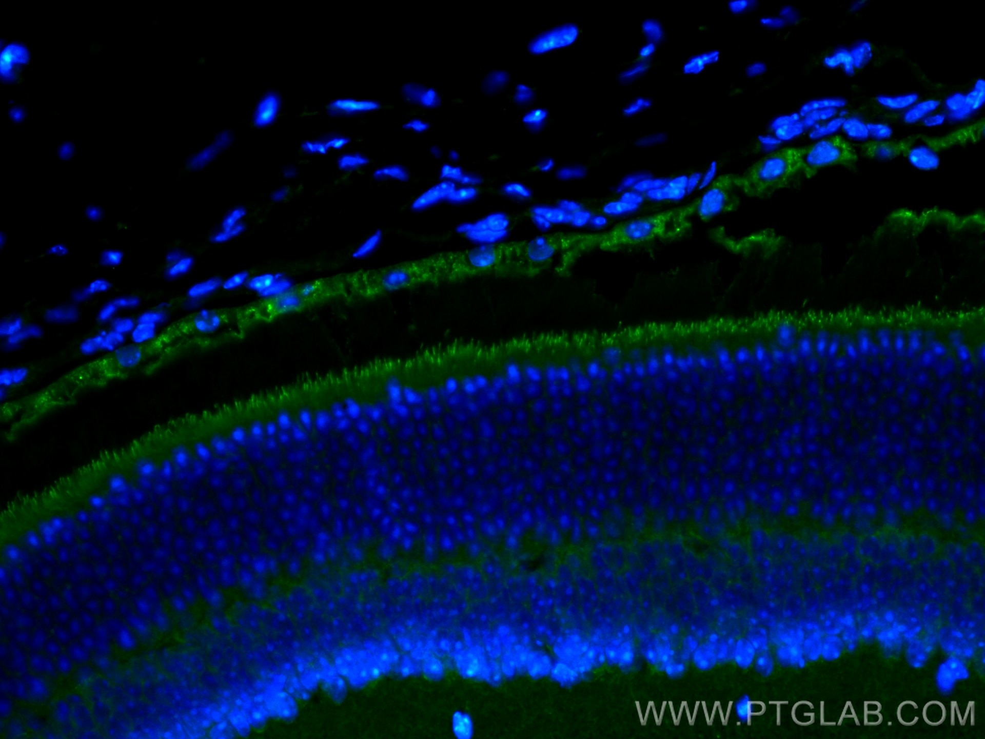 Immunofluorescence (IF) / fluorescent staining of mouse eye tissue using MDM1 Polyclonal antibody (17575-1-AP)