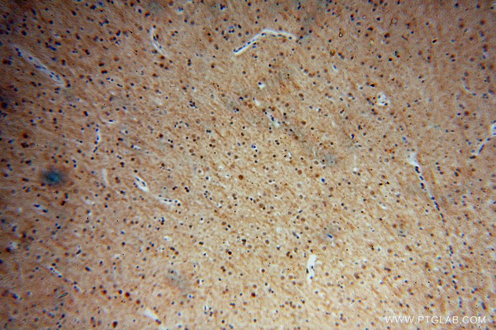 Immunohistochemistry (IHC) staining of human brain tissue using MDM1 Polyclonal antibody (17575-1-AP)