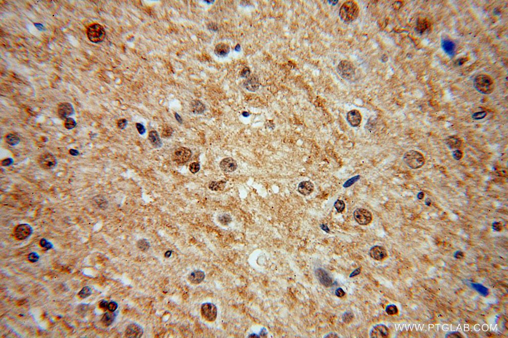 Immunohistochemistry (IHC) staining of human brain tissue using MDM1 Polyclonal antibody (17575-1-AP)