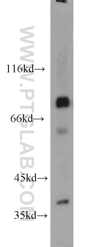 Western Blot (WB) analysis of Raji cells using MDM1 Polyclonal antibody (17575-1-AP)