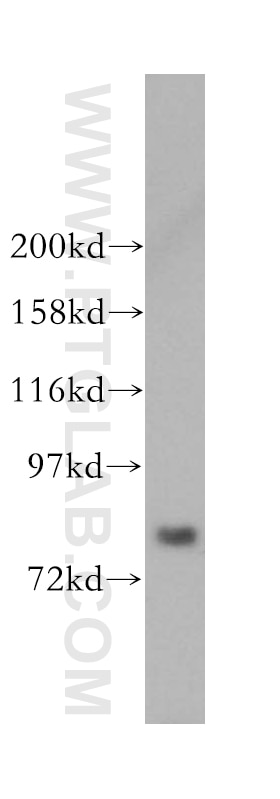 Western Blot (WB) analysis of human brain tissue using MDM1-Specific Polyclonal antibody (16171-1-AP)