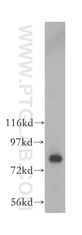 Western Blot (WB) analysis of human brain tissue using MDM1-Specific Polyclonal antibody (16171-1-AP)