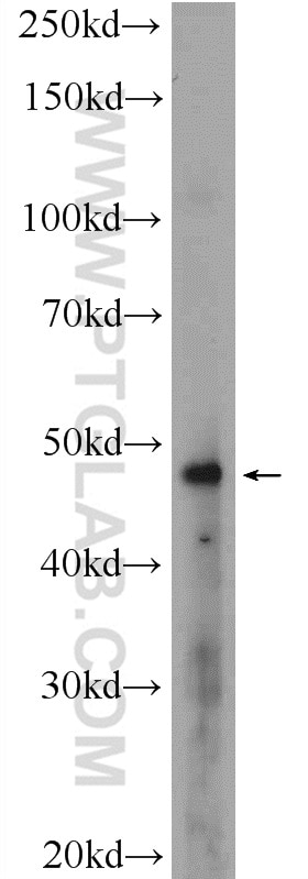 Western Blot (WB) analysis of A431 cells using MDM2 Polyclonal antibody (19058-1-AP)