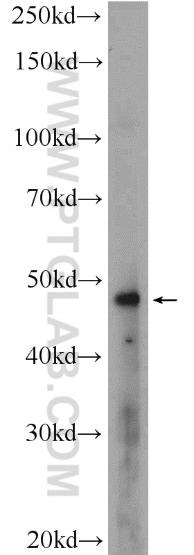 WB analysis of A431 using 19058-1-AP