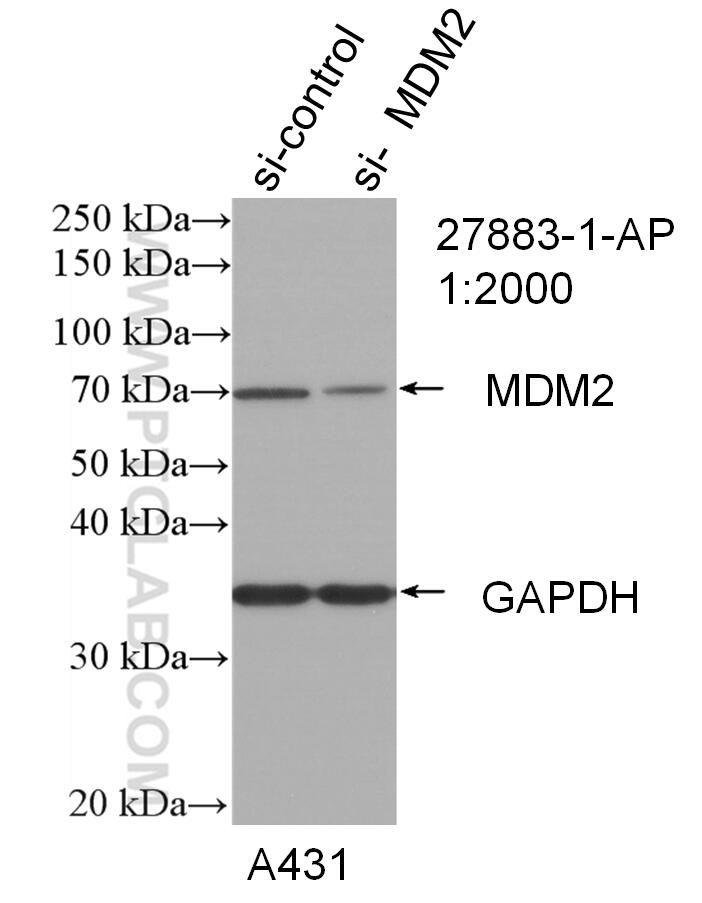 Western Blot (WB) analysis of A431 cells using MDM2 Polyclonal antibody (27883-1-AP)