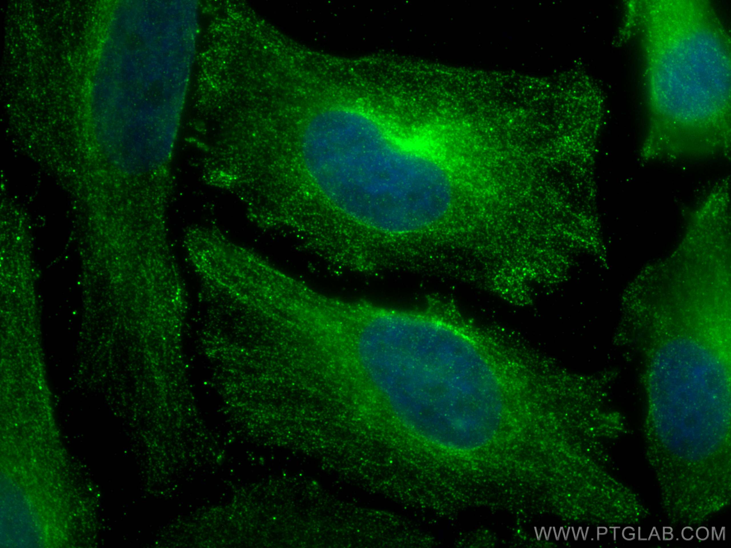 Immunofluorescence (IF) / fluorescent staining of HeLa cells using MDM2 Monoclonal antibody (66511-1-Ig)