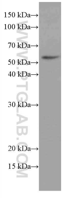 Western Blot (WB) analysis of rat brain tissue using MDM2 Monoclonal antibody (66511-1-Ig)