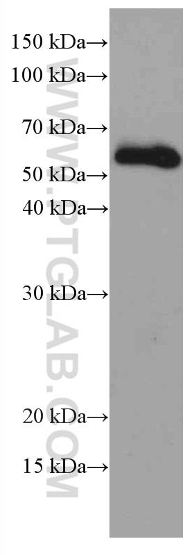 Western Blot (WB) analysis of mouse brain tissue using MDM2 Monoclonal antibody (66511-1-Ig)