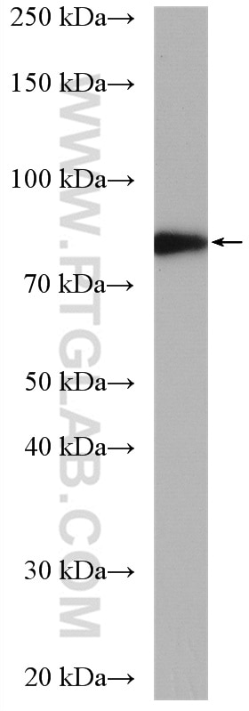 Western Blot (WB) analysis of A375 cells using MDMX Polyclonal antibody (17914-1-AP)