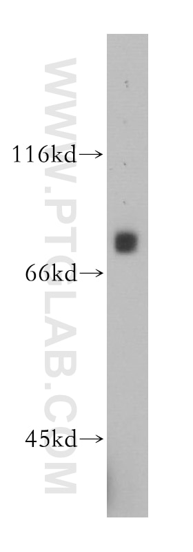 Western Blot (WB) analysis of Raji cells using MDMX Polyclonal antibody (17914-1-AP)