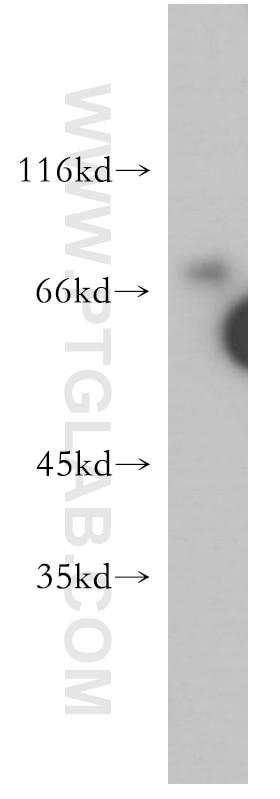 WB analysis of HepG2 using 17914-1-AP