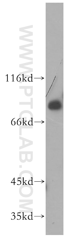 Western Blot (WB) analysis of HeLa cells using MDMX Polyclonal antibody (17914-1-AP)