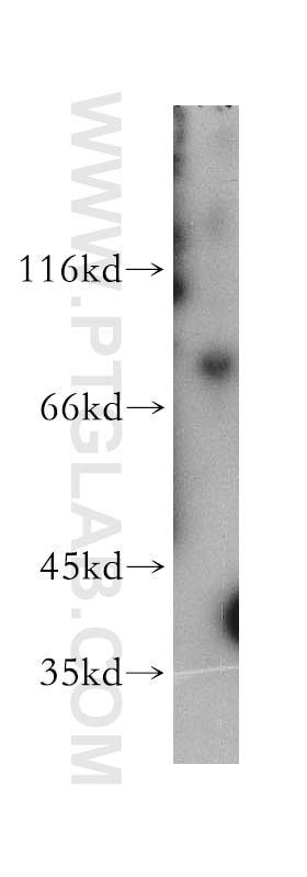 Western Blot (WB) analysis of Apoptosised HeLa cells using MDMX Polyclonal antibody (17914-1-AP)
