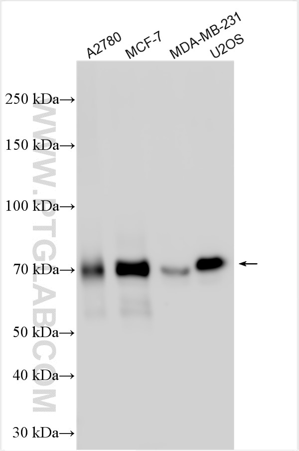 Western Blot (WB) analysis of various lysates using MDMX Polyclonal antibody (28747-1-AP)