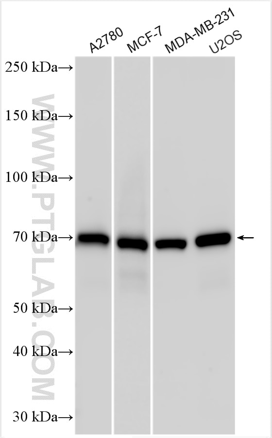 Western Blot (WB) analysis of various lysates using MDMX Polyclonal antibody (28747-1-AP)