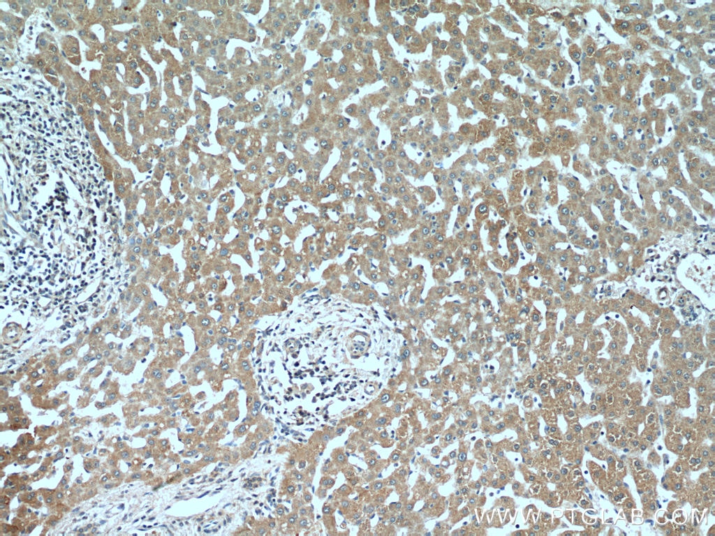 Immunohistochemistry (IHC) staining of human liver tissue using MDP-1 Polyclonal antibody (13929-1-AP)