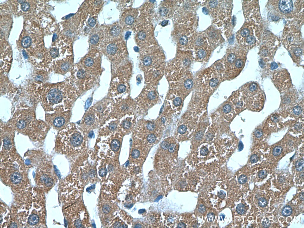 Immunohistochemistry (IHC) staining of human liver tissue using MDP-1 Polyclonal antibody (13929-1-AP)