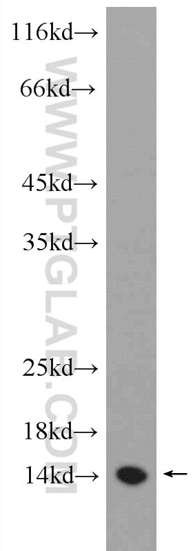 Western Blot (WB) analysis of RAW 264.7 cells using MDP-1 Polyclonal antibody (13929-1-AP)