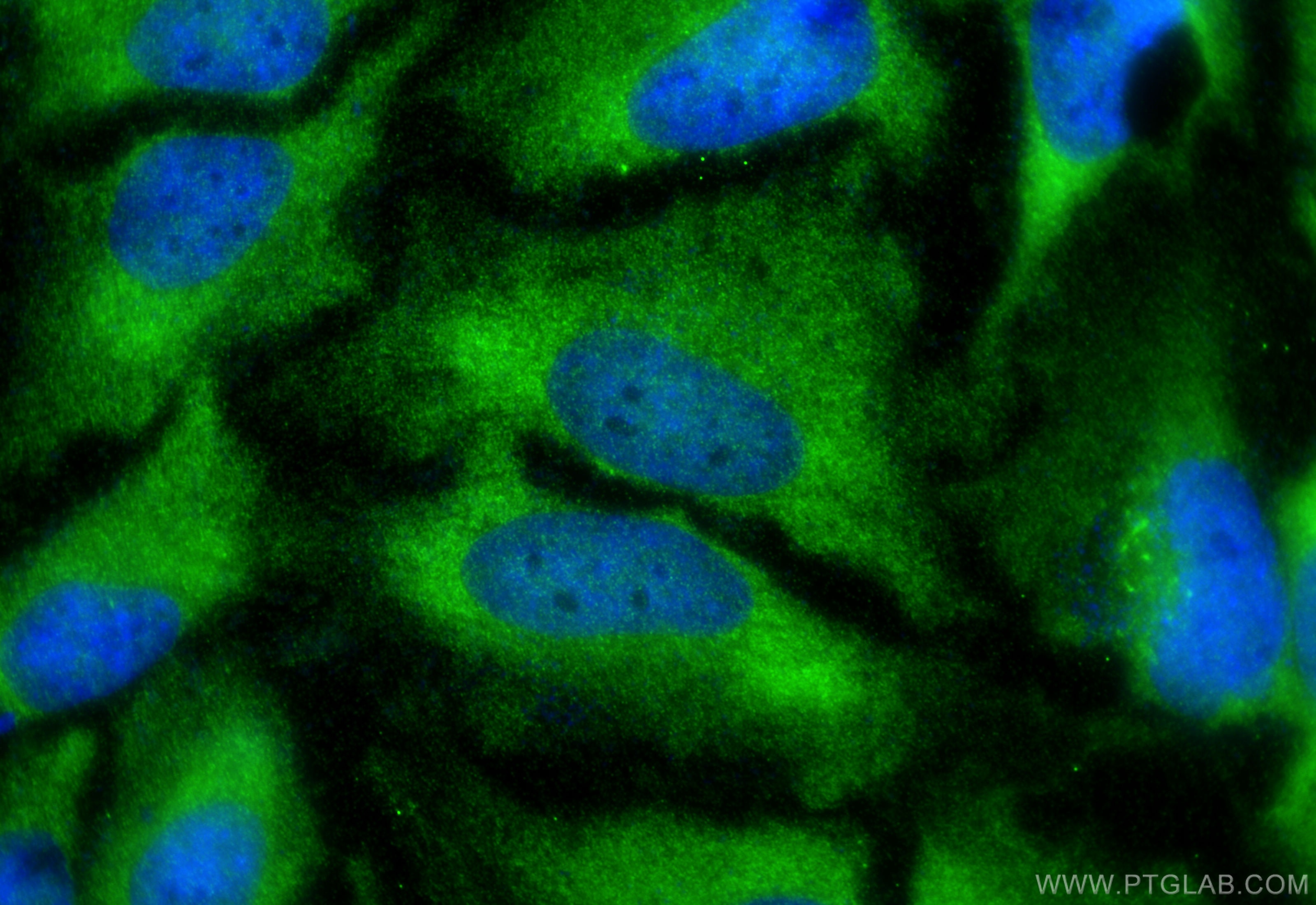 Immunofluorescence (IF) / fluorescent staining of HeLa cells using ME1 Polyclonal antibody (16619-1-AP)