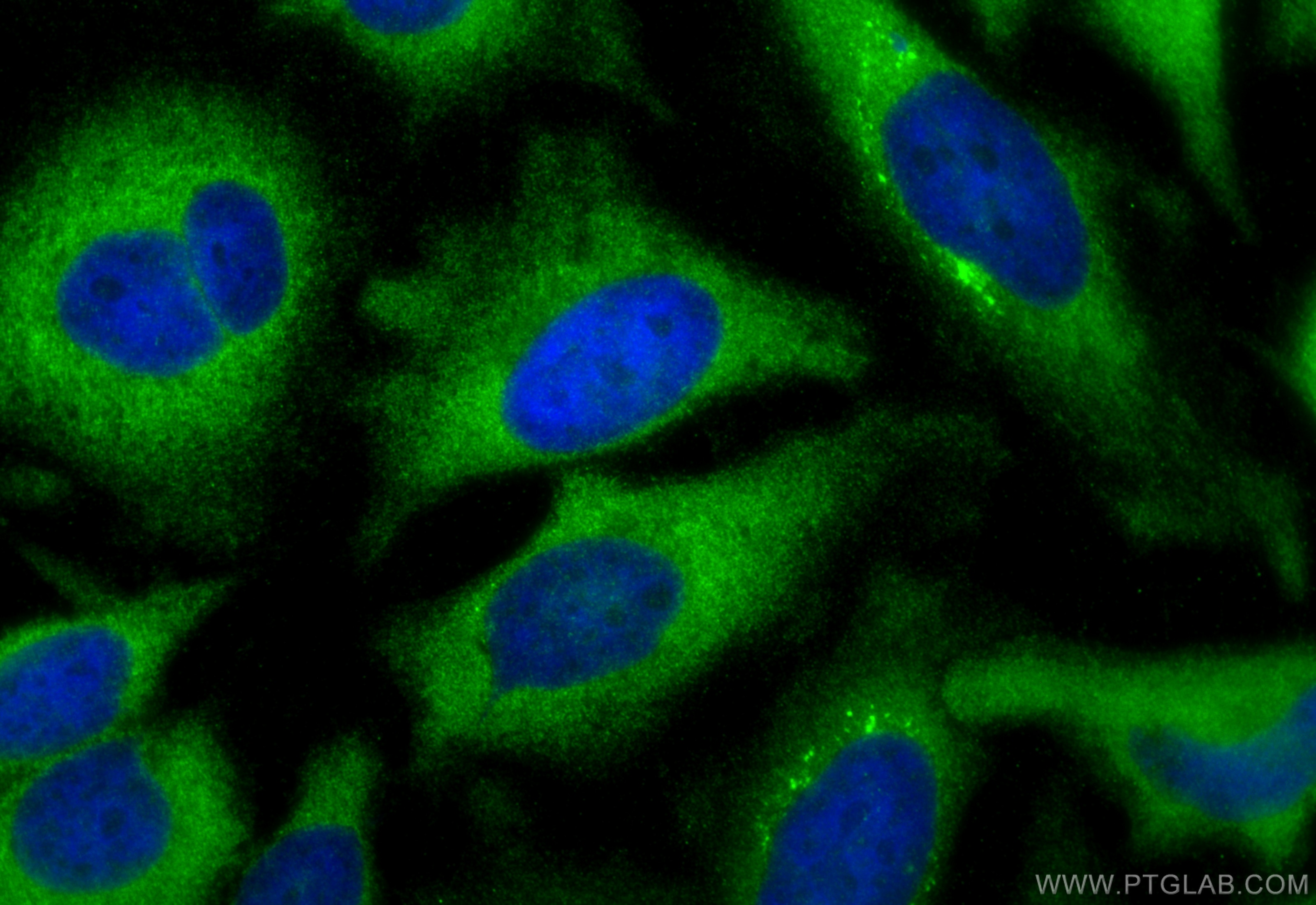 Immunofluorescence (IF) / fluorescent staining of HeLa cells using ME1 Polyclonal antibody (16619-1-AP)