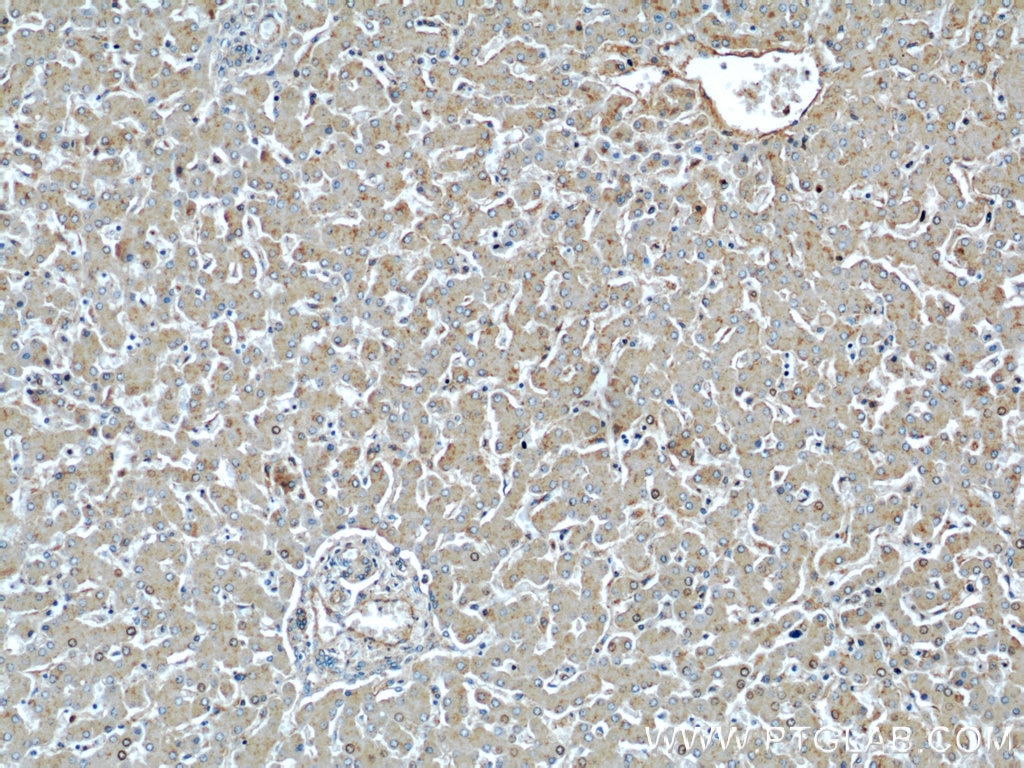 Immunohistochemistry (IHC) staining of human liver tissue using ME1 Polyclonal antibody (16619-1-AP)