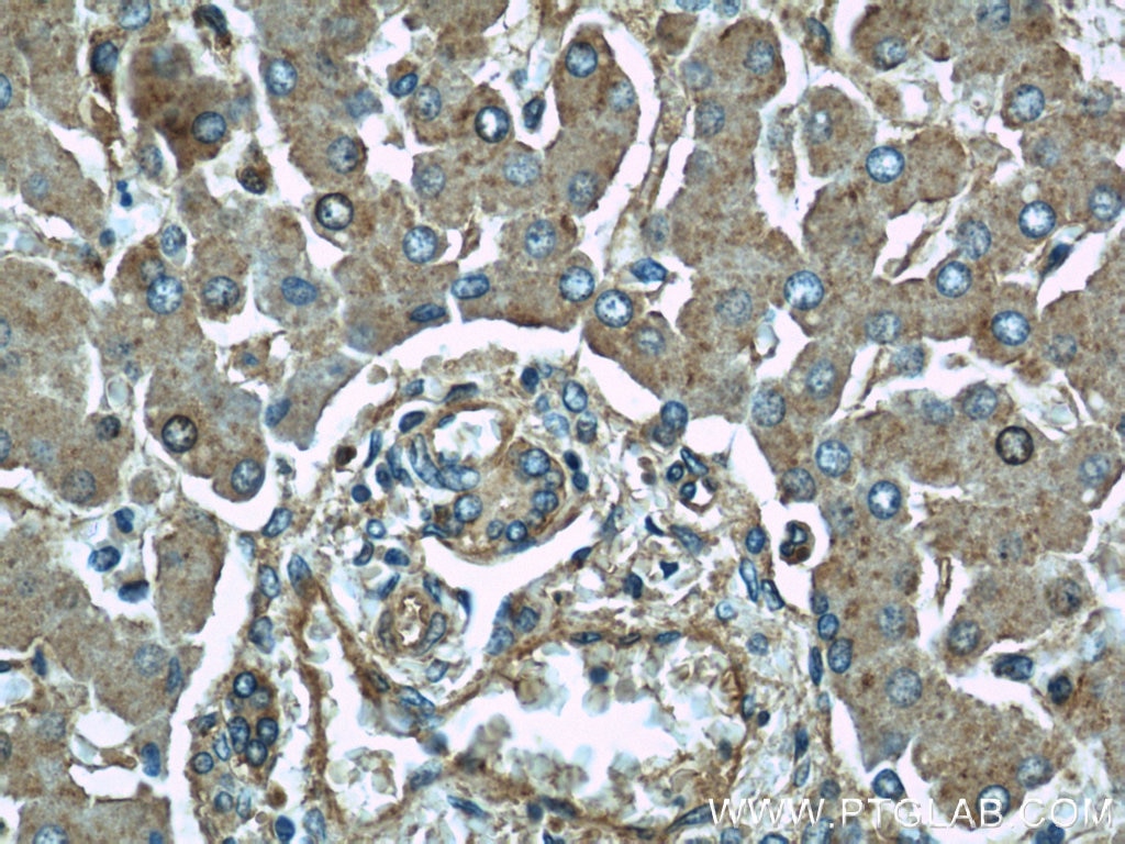 Immunohistochemistry (IHC) staining of human liver tissue using ME1 Polyclonal antibody (16619-1-AP)