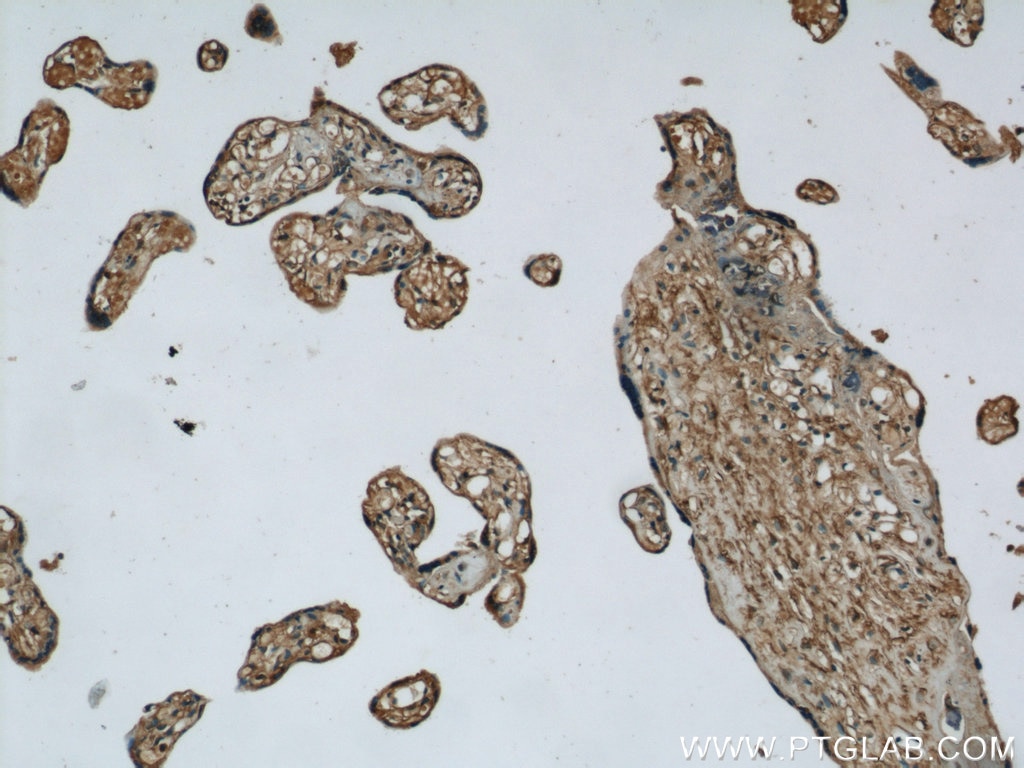 Immunohistochemistry (IHC) staining of human placenta tissue using ME1 Polyclonal antibody (16619-1-AP)