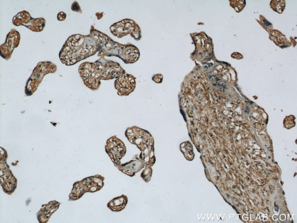 IHC staining of human placenta using 16619-1-AP