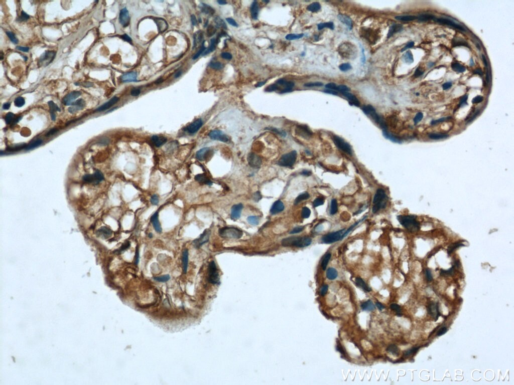 Immunohistochemistry (IHC) staining of human placenta tissue using ME1 Polyclonal antibody (16619-1-AP)