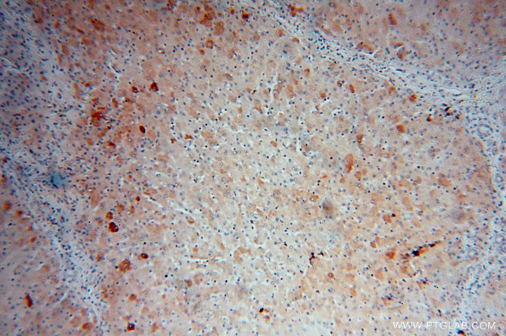 Immunohistochemistry (IHC) staining of human liver tissue using ME1 Polyclonal antibody (16619-1-AP)