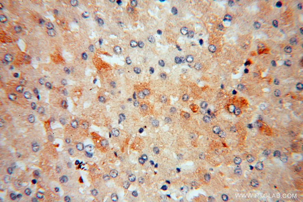 Immunohistochemistry (IHC) staining of human liver tissue using ME1 Polyclonal antibody (16619-1-AP)