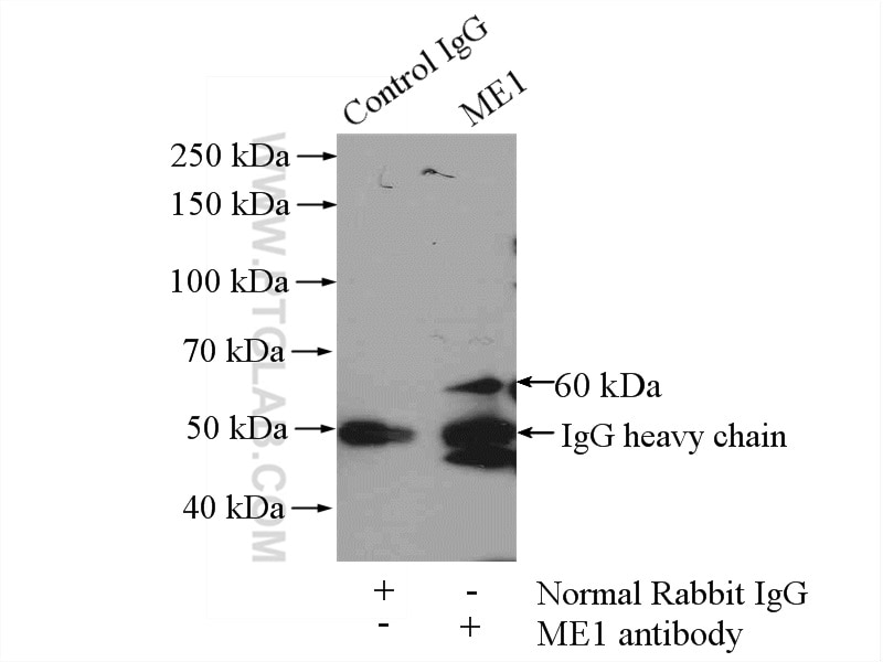 Immunoprecipitation (IP) experiment of mouse liver tissue using ME1 Polyclonal antibody (16619-1-AP)