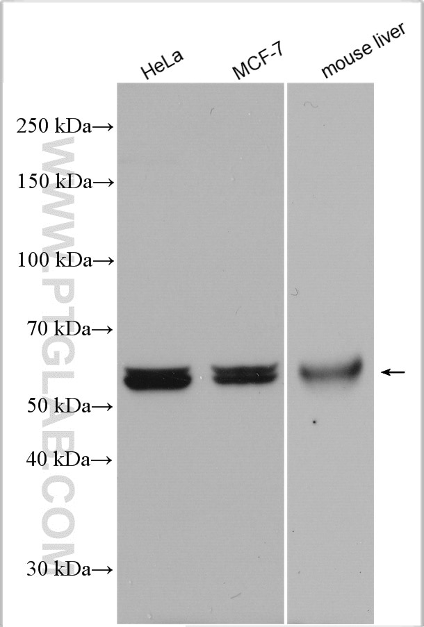 Western Blot (WB) analysis of various lysates using ME1 Polyclonal antibody (16619-1-AP)