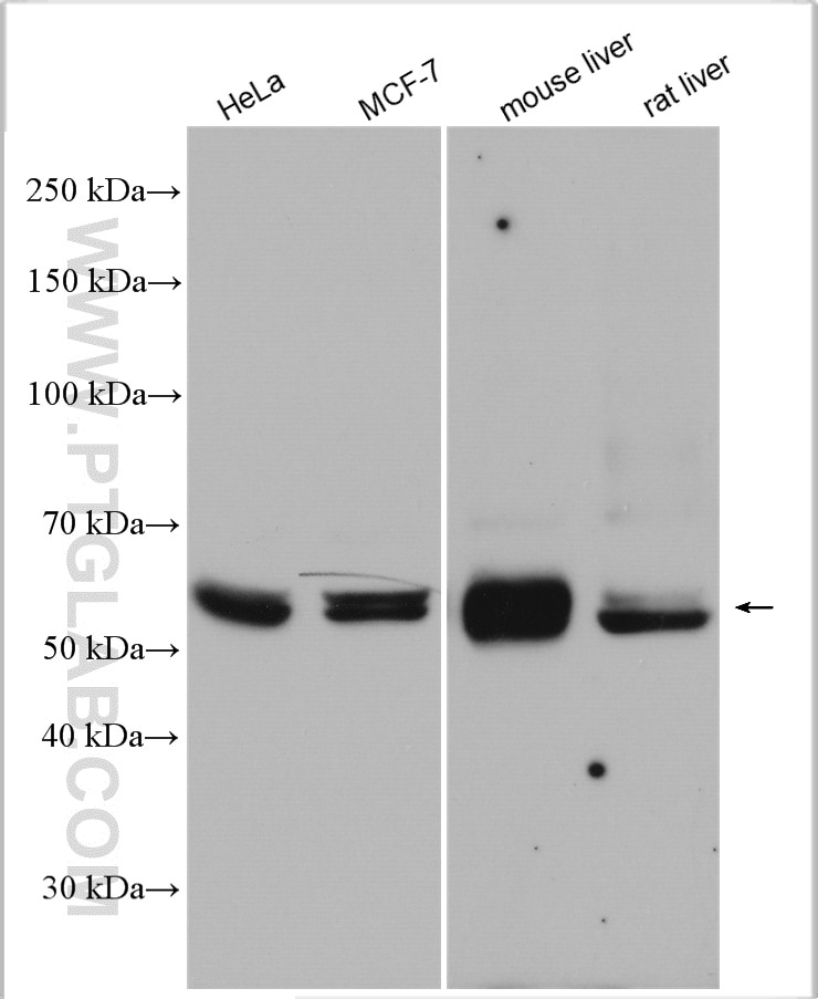 Western Blot (WB) analysis of various lysates using ME1 Polyclonal antibody (16619-1-AP)