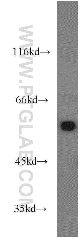 Western Blot (WB) analysis of mouse liver tissue using ME1 Polyclonal antibody (16619-1-AP)