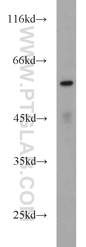 Western Blot (WB) analysis of mouse placenta tissue using ME1 Polyclonal antibody (16619-1-AP)
