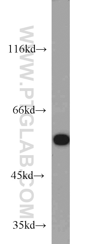 Western Blot (WB) analysis of mouse liver tissue using ME1 Polyclonal antibody (16619-1-AP)