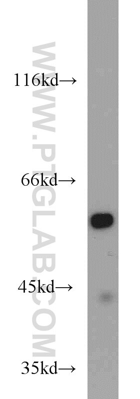 Western Blot (WB) analysis of mouse liver tissue using ME1 Polyclonal antibody (16619-1-AP)