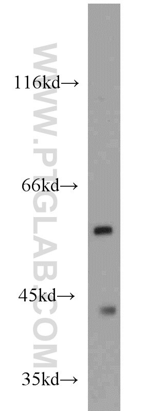 Western Blot (WB) analysis of mouse liver tissue using ME1 Polyclonal antibody (16619-1-AP)