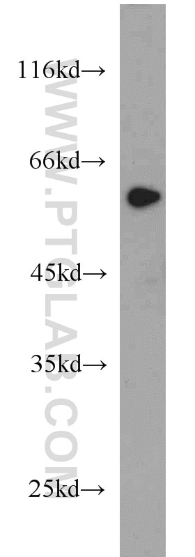 Western Blot (WB) analysis of mouse liver tissue using ME1 Polyclonal antibody (16619-1-AP)